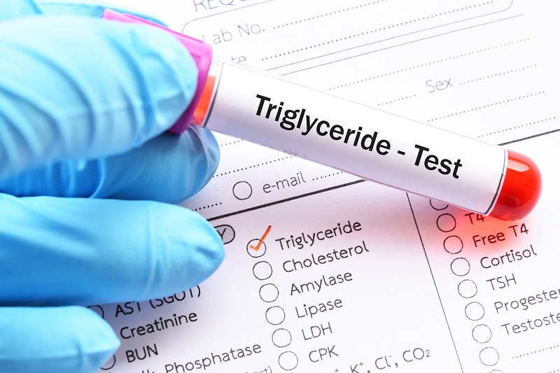 Triglyceride test